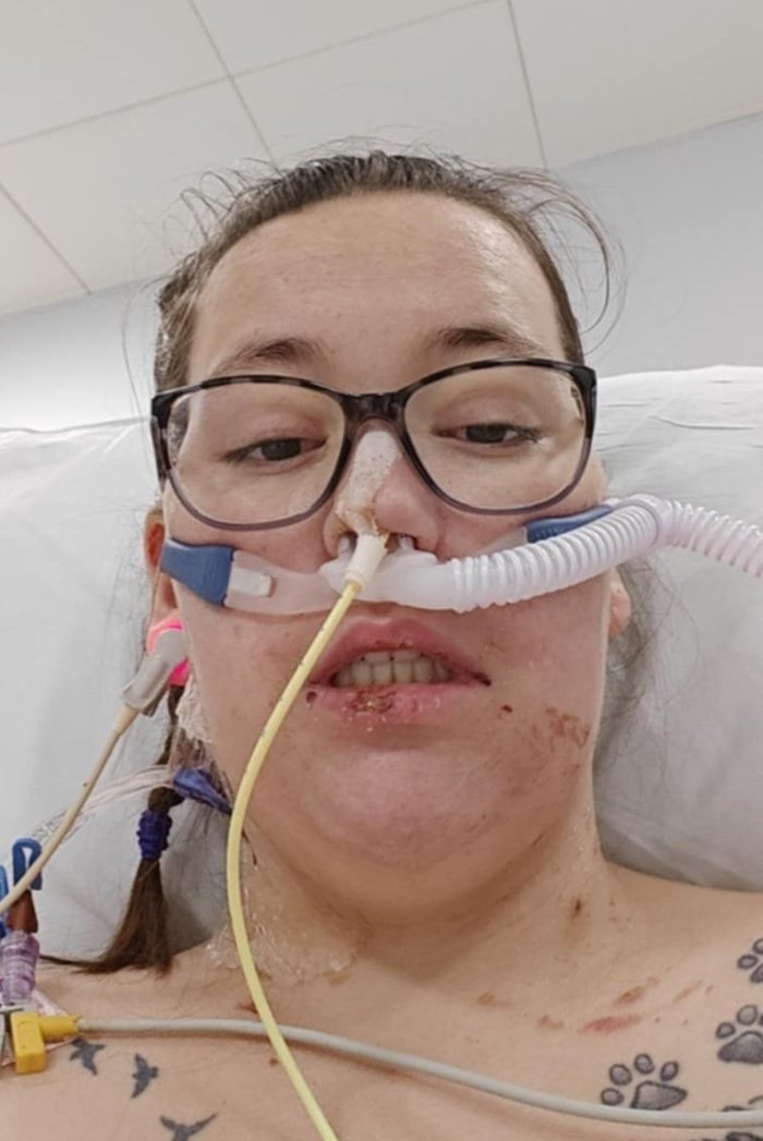 A photo of Marie having treatment in hospital.