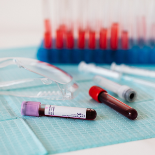 Two samples of blood in tests tubes laid down next to safety goggles in a laboratory with more test tubes in the background.