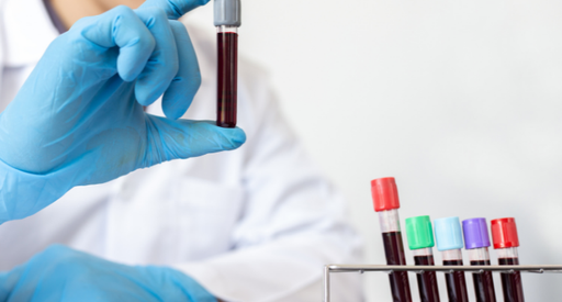 A blood cancer researcher lifts up a vial of blood from a rack of other vials of blood.