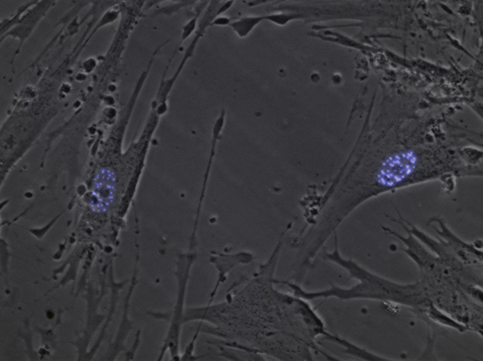 A close up of nuclear microspeckles in APL