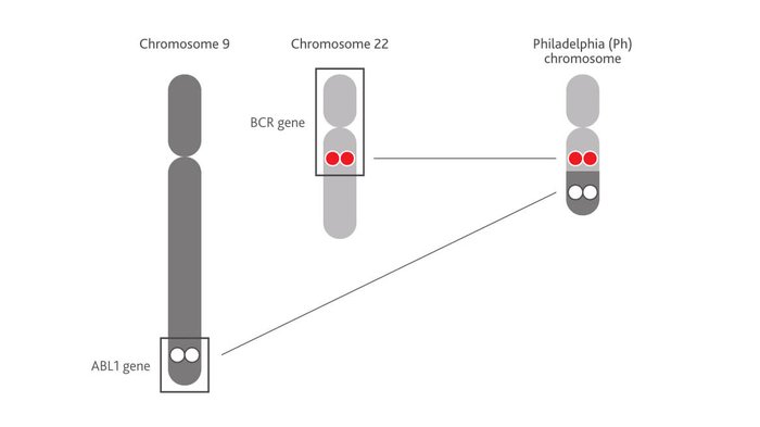 A diagram showing the philadelphia positive chromosones