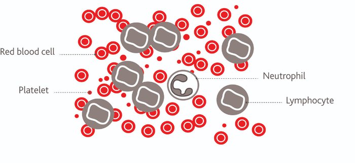 A diagram showing abnormal blood