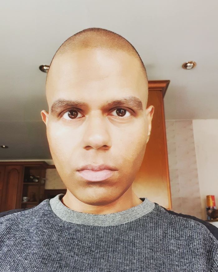 Sunny, diagnosed with non Hodgkin lymphoma